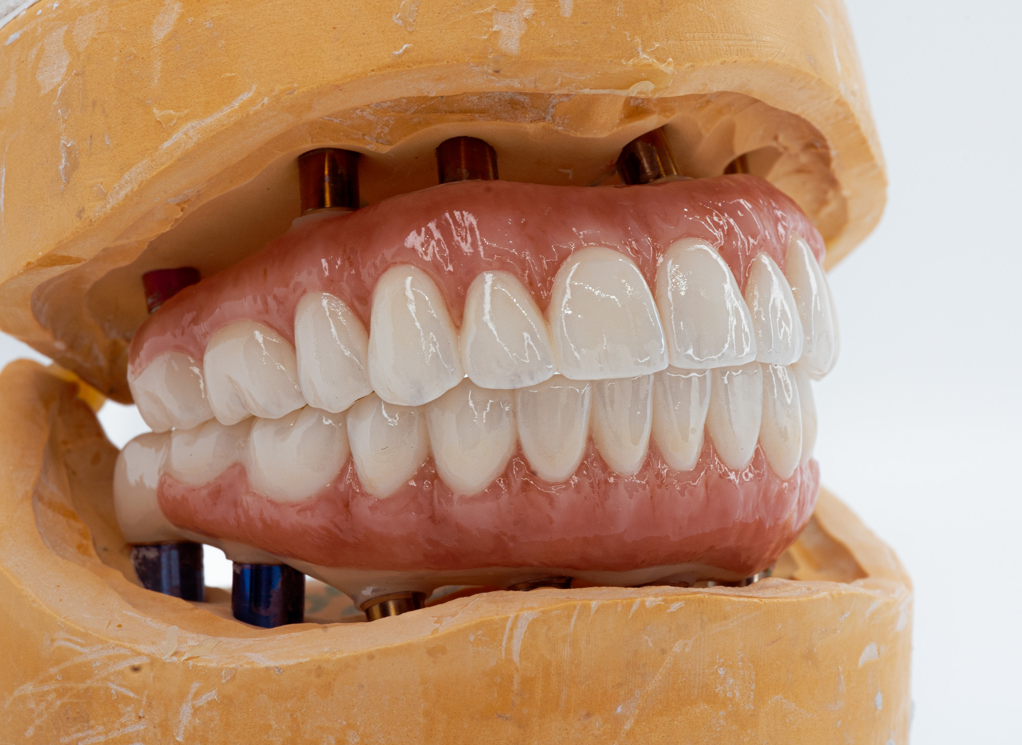 歯科 ZERO別冊 歯牙形態 Natural Tooth Morphology 歯科 ZERO別冊 歯牙形態 Natural Tooth Morphology
